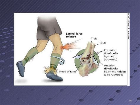 The Lower Leg And Ankle F09