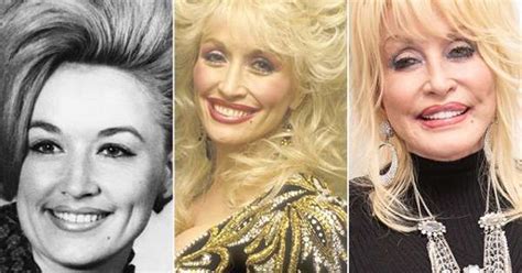 Dolly Parton's plastic surgery transformation is something ...