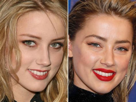 Amber Heard Before And After Amber Heard Botox Natural Dark Blonde