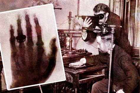 How X Rays Were Discovered Victorian Medical Tech We Still Use Every