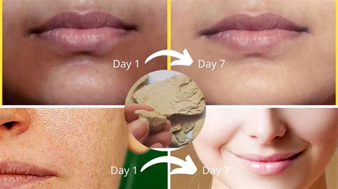 Even Skin Tone Treatment At Home How To Get Even Skin Tone On Face