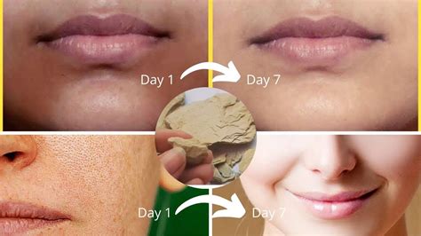 Even Skin Tone Treatment At Home How To Get Even Skin Tone On Face