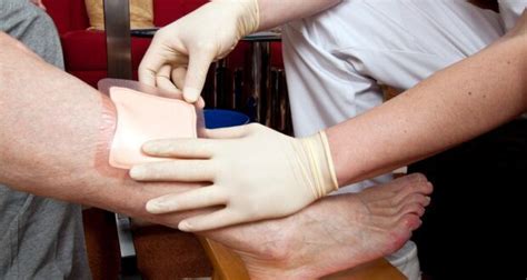 Lower Limb Wound Care Lacks Priority And Investment Argues Mp