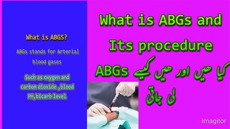 What Isabgs And Procedure Of Abgs In Short Youtube