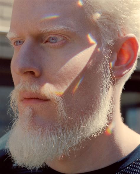 Meet Albino Model Stephen Thompson