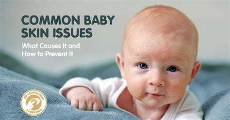 Video How Residues Left In Clothes Can Harm Your Babys Skin