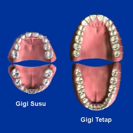 Pen&abutan gigi susu 'a(a anak (i masa gigi 'ergantian (mix dentition) agar dentition) agar gig non me(is 2 1 bua) k. TANDA-TANDA GIGI SUSU BAYI TUMBUH | Explorasi Sihat......