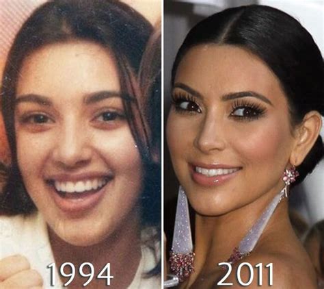 kim kardashian eyelift before and after kim kardashian before kim kardashian surgery