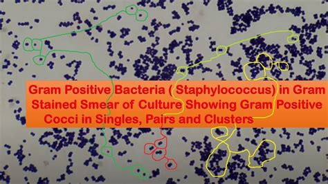Gram Positive Bacteria In Gram Stain Gpc Gpc In Singles Pairs