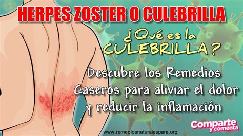 HERPES EN LA PIEL Como curar la CULEBRILLA HERPES ZOSTER Rápido con Remedios Caseros