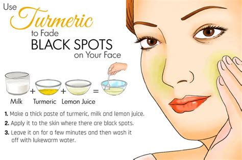 Remove Dark Spots Easily And Quickly With These Home Remedies