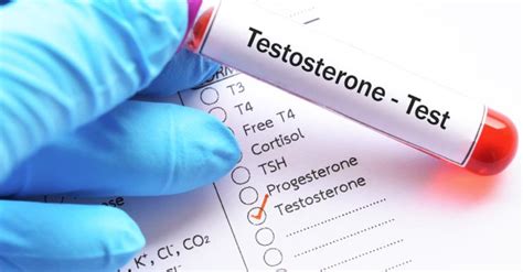 Treatment Options For Low Testosterone Levels Rx Adviser