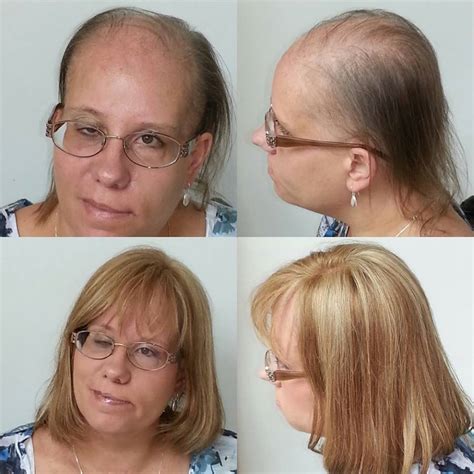 When considering glue in extensions and hair loss, the best thing to do is to get them professionally done. Lace wigs before and after,why wear lace wigs so important?