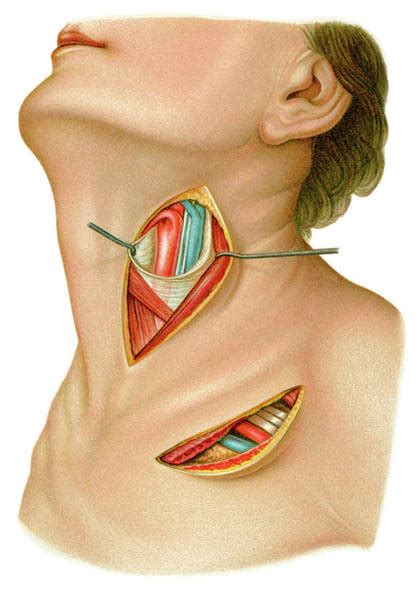 Origin the right common carotid artery originates behind the sternoclavicular. Subclavian Artery Photographs | Fine Art America