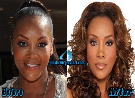 Vivica Fox Plastic Surgery Before And After Photos Plastic Surgery Facts