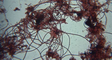 Filamentous Bacteria Ask Microbiology