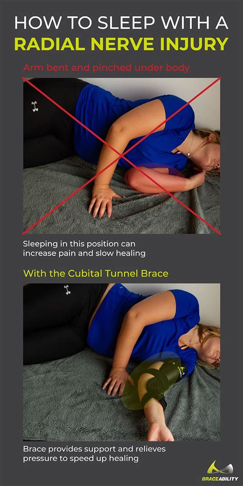 Brace Elbow Splint Brace Ulnar Nerve Entrapment Cubital Tunnel For