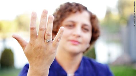 Womans Persistence Pays Off In Regenerated Fingertip