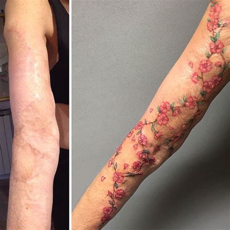 55 Incredible Scar Tattoo Cover Ups Transforming Imperfections Into