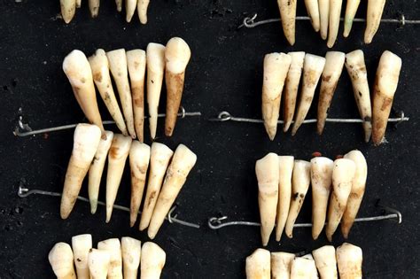 The Dentures Made From The Teeth Of Dead Soldiers At Waterloo Bbc News