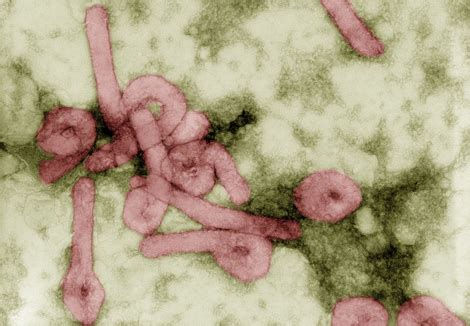 Jun 16, 2021 · in den sozialen medien sorgt das schild jedenfalls gerade für jede menge aufregung. RKI - Infektionskrankheiten A-Z - Marburgvirus-Infektionen