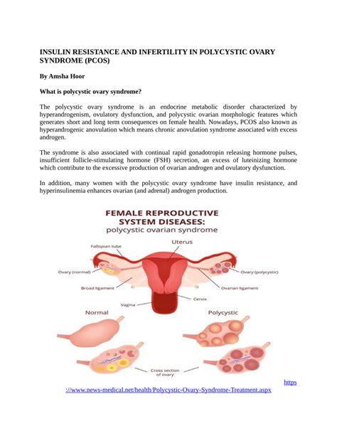 Pdf Insulin Resistance And Infertility In Polycystic Ovary Syndrome