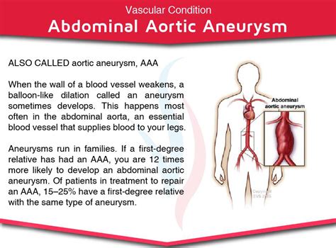 Abdominal Aortic Aneurysm Screening Treatment And