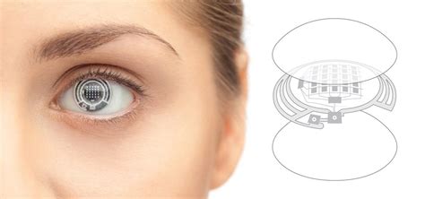The Smart Contact Lens Evolves As Researchers Develop A Prototype That Detects An Array Of