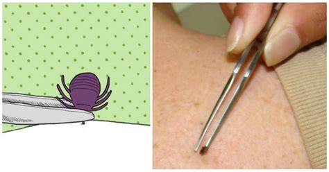 Things You Should Or Shouldnt Do When You Find A Tick Stuck On Your Skin