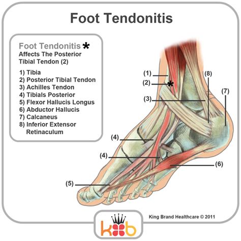 Foot Tendon Anatomy Diagram