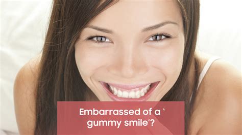Embarrassed Of A ‘gummy Smile Dawson Dental