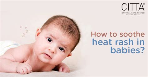 How To Treat Heat Rash In Babies Citta