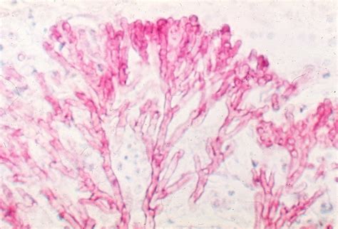 M141 1 Aspergillus Fumigatus Typical Dichotomous Branchin Flickr