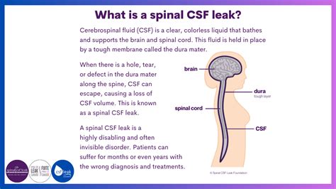 Cerebrospinal Fluid Leak Spine