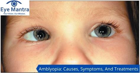 Amblyopia Causes Symptoms And Treatment Lazy Eye Treatment