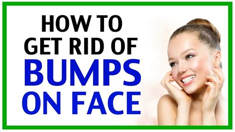 Learn Effective Ways On How To Get Rid Of Bumps On Face Vrogue