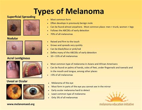 Melanomas Color Is Usually