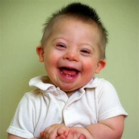 A Special Joy 3 Babies With Down Syndrome Beautiful