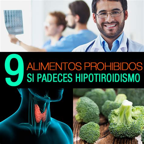 10 Alimentos Prohibidos Si Padeces Hipotiroidismo La Guía De Las
