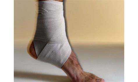 Sprained Ankle Could Pose Longer Term Harms To Health