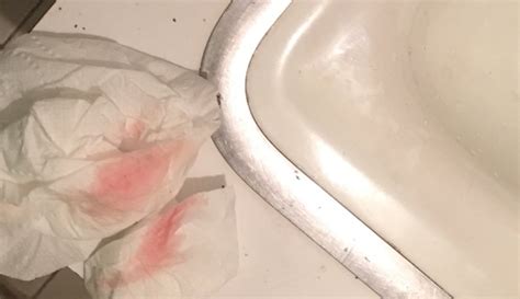 Watery pink discharge slightly red 2 days before period. Light pink spotting what could it be ? Do NOT OPEN if you ...