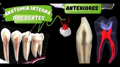 Anatomia Interna Dos Dentes Anteriores ENDODONTIA YouTube