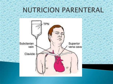 Diferen A Entre Nutri O Enteral E Parenteral Edubrainaz