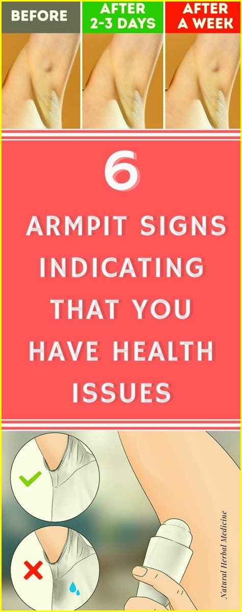 Armpit Signs Indicating That You Have Health Issues
