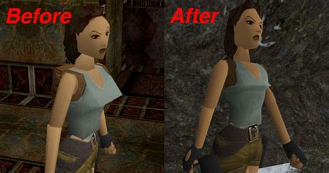 Lara Croft Undergoes Triangle Reduction Surgery