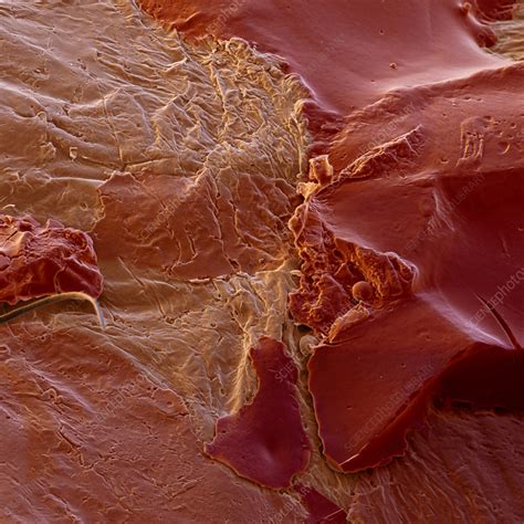 Healing Wound Sem Stock Image M3301290 Science Photo Library