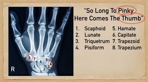 Carpal Bone Mnemonic And Names Wrist Anatomy Made Easy — Ezmed In 2021