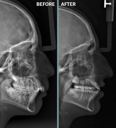 From his fellow art students in the 1960s to. Braces Mississippi | Dr. Turgeau