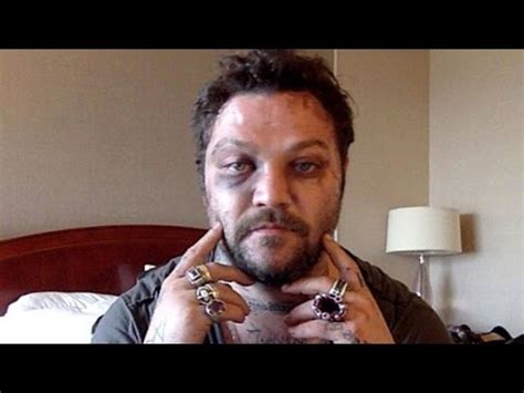Brandon cole bam margera is an american skateboarder, stunt performer, television personality, and filmmaker. Bam Margera Shares Brutal Injury Photos After Attack by ...