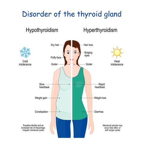 Hypothyroidism Weight Gain Hair Loss Blog Dandk